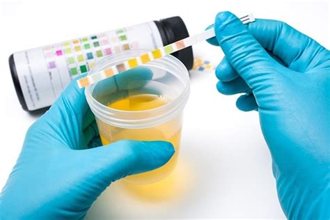 urine testing procedure